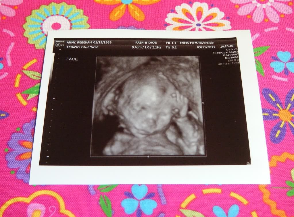 3d ultrasound 20 weeks boy. 20 week 3D ultrasound pictures