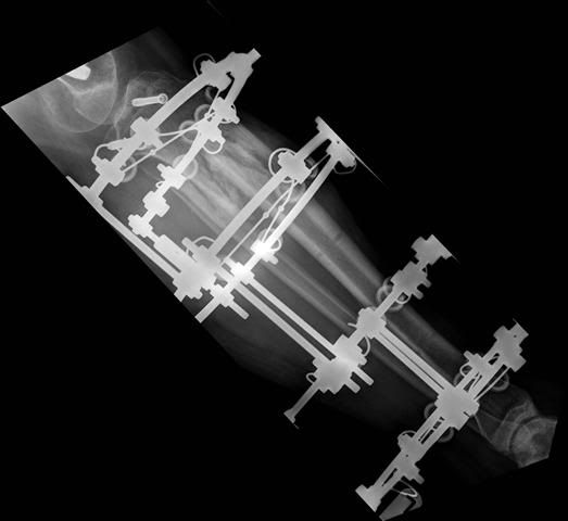 [Image: xray7.jpg]