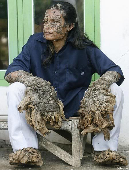 tree man. tree man feet. tree man feet.