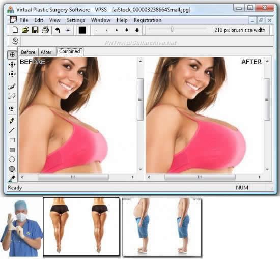 http://i270.photobucket.com/albums/jj88/malinamaniac/PROGRAMAS/CIRUGIA_PLASTICA_VIRTUAL.jpg